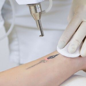 7581137cd5d6eeda3eb064048d03a6ab 1.jpg