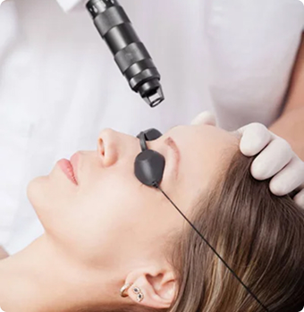 DERMAPEN Cara 3 sesiones 31.jpg