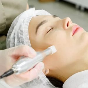 DERMAPEN Cara 3 sesiones 38.jpg