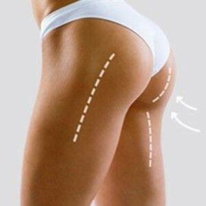 be6558460e6b5ea47626ad2ca640e170 1.jpg